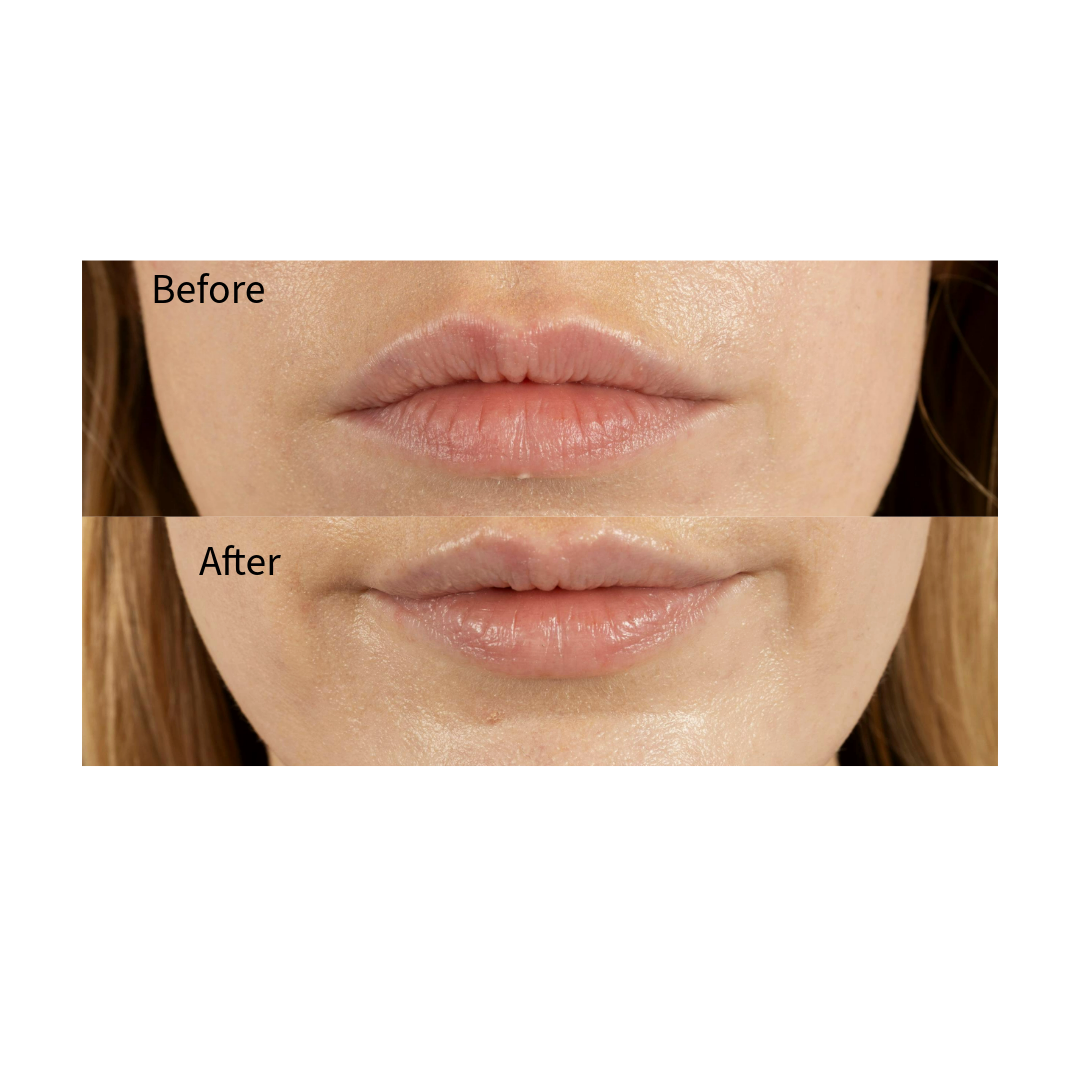 Comfort Lip Balm